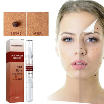 Wipeoff Tags & Moles Remover,wipeoff Tags & Moles Remove 1021 sold