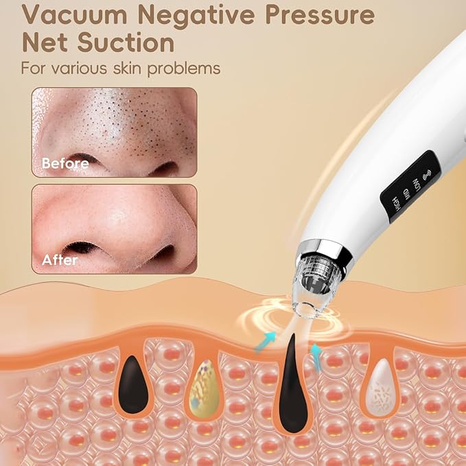 Facial Pore Blackhead Remover Vacuum